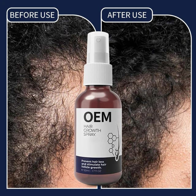 FEG  Hair Growth Spray